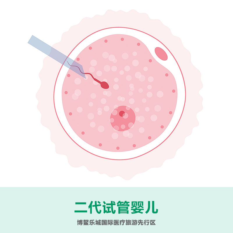 二代試管嬰兒