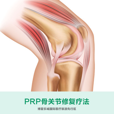PRP骨关节调护方案