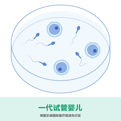 一代试管婴儿