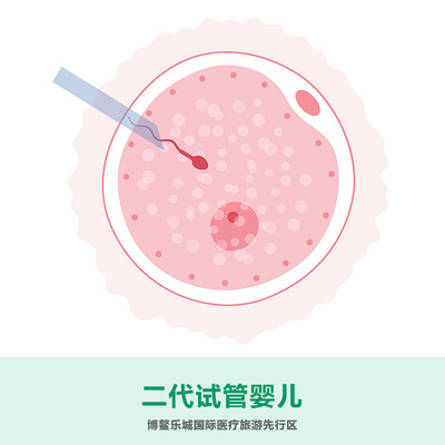 二代试管婴儿
